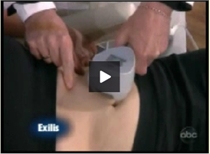 Exilis video